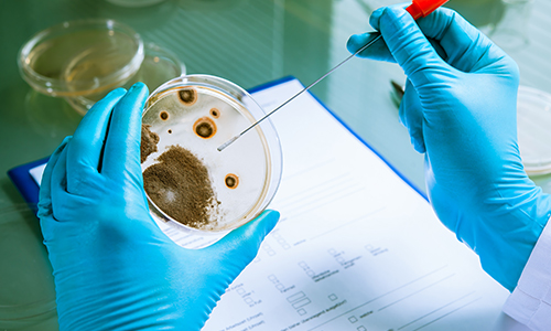 抗菌检测方法-抑菌圈实验