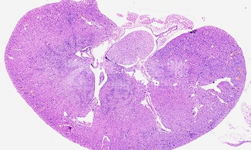 HE染色切片和免疫组化染色的不同点