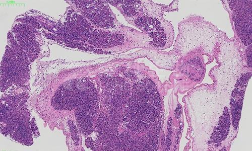石蜡切片及染色技术的注意事项