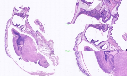 冰冻切片和石蜡切片的区别